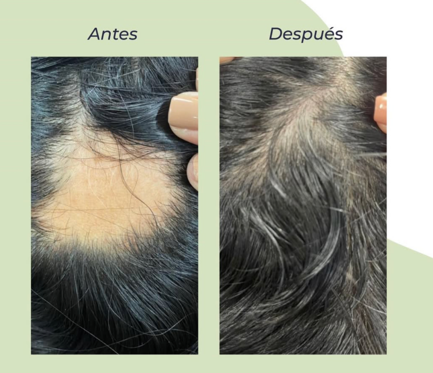 Concentrado de biotina y colágeno